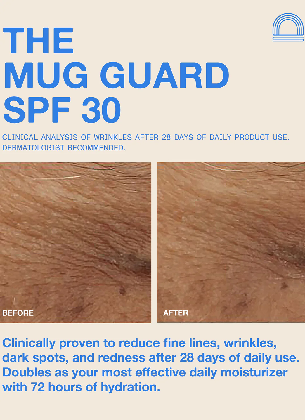 DUNE SUNCARE The Mug Guard Face Gel SPF 30 Suncare 2.4 fl oz - Image 4